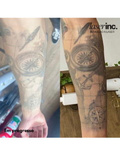 Em progresso - 5